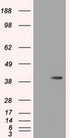 HIBCH Antibody - HEK293T cells were transfected with the pCMV6-ENTRY control (Left lane) or pCMV6-ENTRY HIBCH (Right lane) cDNA for 48 hrs and lysed. Equivalent amounts of cell lysates (5 ug per lane) were separated by SDS-PAGE and immunoblotted with anti-HIBCH.