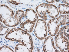 HIBCH Antibody - IHC of paraffin-embedded Human Kidney tissue using anti-HIBCH mouse monoclonal antibody. (Dilution 1:50).