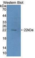 HIBCH Antibody - Western Blot; Sample: Recombinant protein.