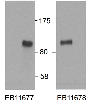 HIC1 Antibody - HIC1 antibody HEK293 overexpressing Human HIC1 and probed with (0.5 ug/ml) with the mock transfection in second lane. Data obtained from Dr. D. Leprince, CNRS UMR 8161, Institut de Biologie de LILLE, France