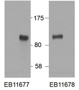 HIC1 Antibody - HIC1 antibody HEK293 overexpressing Human HIC1 and probed with (0.5 ug/ml) with the mock transfection in second lane. Data obtained from Dr. D. Leprince, CNRS UMR 8161, Institut de Biologie de LILLE, France