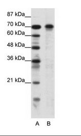 HIC1 Antibody - A: Marker, B: Jurkat Cell Lysate.  This image was taken for the unconjugated form of this product. Other forms have not been tested.