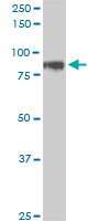 HIC1 Antibody - HIC1 monoclonal antibody (M01), clone 4E11. Western Blot analysis of HIC1 expression in PC-12.