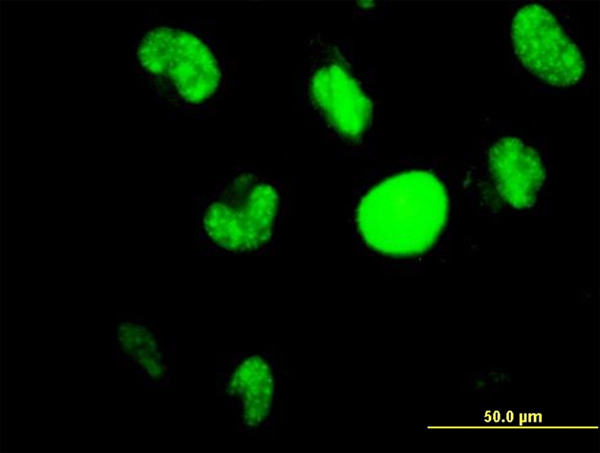 HIC1 Antibody - Immunofluorescence of monoclonal antibody to HIC1 on HeLa cell. [antibody concentration 10 ug/ml]