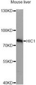 HIC1 Antibody - Western blot analysis of extracts of mouse liver, using HIC1 antibody at 1:3000 dilution. The secondary antibody used was an HRP Goat Anti-Rabbit IgG (H+L) at 1:10000 dilution. Lysates were loaded 25ug per lane and 3% nonfat dry milk in TBST was used for blocking. An ECL Kit was used for detection and the exposure time was 90s.
