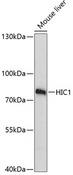 HIC1 Antibody - Western blot analysis of extracts of mouse liver using HIC1 Polyclonal Antibody at dilution of 1:3000.