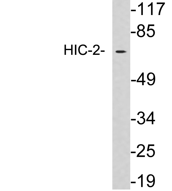 HIC2 Antibody - Western blot analysis of lysates from HepG2 cells, using HIC-2 antibody.