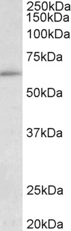 HIC2 Antibody - HIC2 antibody (0.1 ug/ml) staining of HepG2 lysate (35 ug protein in RIPA buffer). Primary incubation was 1 hour. Detected by chemiluminescence.