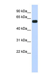 HIC2 Antibody - HIC2 antibody Western blot of Fetal Brain lysate. This image was taken for the unconjugated form of this product. Other forms have not been tested.