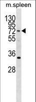 HIC2 Antibody - HIC2 Antibody western blot of mouse spleen tissue lysates (35 ug/lane). The HIC2 antibody detected the HIC2 protein (arrow).