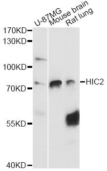 HIC2 Antibody - Western blot analysis of extracts of various cell lines, using HIC2 antibody at 1:3000 dilution. The secondary antibody used was an HRP Goat Anti-Rabbit IgG (H+L) at 1:10000 dilution. Lysates were loaded 25ug per lane and 3% nonfat dry milk in TBST was used for blocking. An ECL Kit was used for detection and the exposure time was 90s.