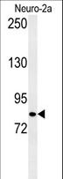 HID1 / C17orf28 Antibody - Western blot of CQ028 Antibody in Neuro-2a cell line lysates (35 ug/lane). CQ028 (arrow) was detected using the purified antibody.