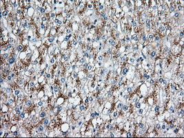 HID1 / C17orf28 Antibody - Immunohistochemical staining of paraffin-embedded Human liver tissue using anti-C17orf28 mouse monoclonal antibody. (Dilution 1:50).