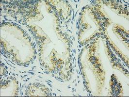 HID1 / C17orf28 Antibody - IHC of paraffin-embedded Human prostate tissue using anti-C17orf28 mouse monoclonal antibody. (Dilution 1:50).