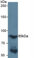 HIF1A / HIF1 Alpha Antibody - Western Blot; Sample: Human Serum.