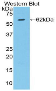 HIF1A / HIF1 Alpha Antibody - Western blot of HIF1A / HIF1 Alpha antibody.