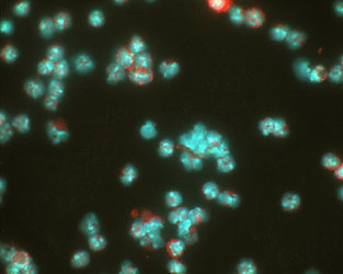 HIF1A / HIF1 Alpha Antibody - Detection of HIF-1 alpha (red dye) in a cell cytospin from a lavage of a murine skin pouch infected with Staph Aureus. Blue dye is DAPI nuclear staining. Photos courtesy of Susan Alexander and Hattie Gresham, PhD.  This image was taken for the unconjugated form of this product. Other forms have not been tested.