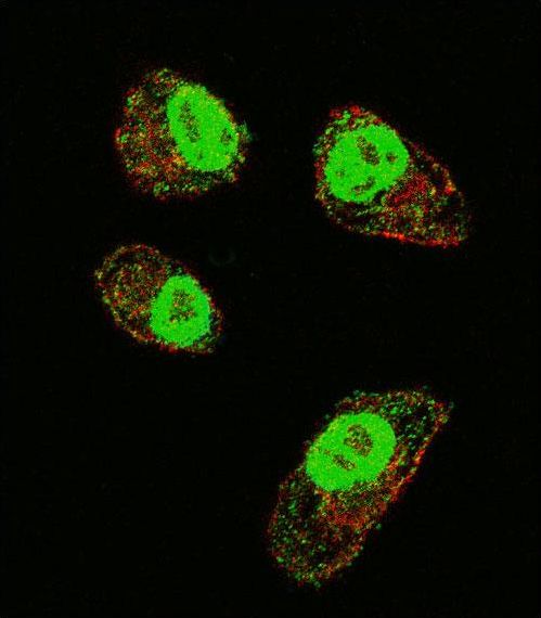 HIF1A / HIF1 Alpha Antibody - Confocal immunofluorescence of HIF1Alpha Antibody with MDA-MB231 cell followed by Alexa Fluor 488-conjugated goat anti-rabbit lgG (green). Actin filaments have been labeled with Alexa Fluor 555 phalloidin (red).