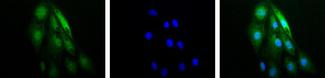 HIF1A / HIF1 Alpha Antibody - Placenta, Villi 40X.  This image was taken for the unconjugated form of this product. Other forms have not been tested.