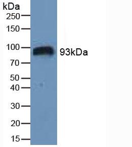 HIF1A / HIF1 Alpha Antibody - Western Blot; Sample: Human Serum.