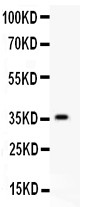 HIF1A / HIF1 Alpha Antibody - HIF 1 alpha antibody Western blot. All lanes: Anti HIF 1 alpha at 0.5 ug/ml. WB: Recombinant Human HIF 1 alpha Protein 0.5ng. Predicted band size: 36 kD. Observed band size: 36 kD.