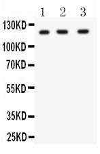HIF1A / HIF1 Alpha Antibody - HIF 1 alpha antibody Western blot. All lanes: Anti HIF 1 alpha at 0.5 ug/ml. Lane 1: HELA Whole Cell Lysate at 40 ug. Lane 2: SHG Whole Cell Lysate at 40 ug. Lane 3: HEPA Whole Cell Lysate at 40 ug. Predicted band size: 93 kD. Observed band size: 120 kD.