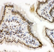 HIF1A / HIF1 Alpha Antibody - HIF 1 alpha antibody IHC-paraffin: Mouse Intestine Tissue.