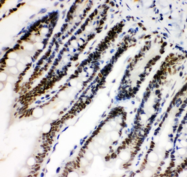 HIF1A / HIF1 Alpha Antibody - HIF 1 alpha antibody IHC-paraffin: Rat Intestine Tissue.