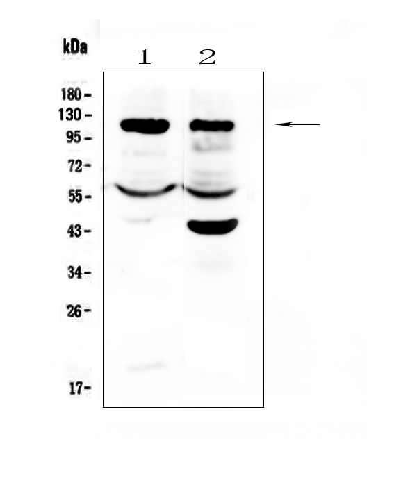 HIF1A / HIF1 Alpha Antibody - Western blot analysis of HIF-1-alpha/HIF1A using anti-HIF-1-alpha/HIF1A antibody. Electrophoresis was performed on a 5-20% SDS-PAGE gel at 70V (Stacking gel) / 90V (Resolving gel) for 2-3 hours. The sample well of each lane was loaded with 50ug of sample under reducing conditions. Lane 1: human PC-3 whole cell lysates, Lane 2: human Caco-2 whole cell lysates. After Electrophoresis, proteins were transferred to a Nitrocellulose membrane at 150mA for 50-90 minutes. Blocked the membrane with 5% Non-fat Milk/ TBS for 1.5 hour at RT. The membrane was incubated with rabbit anti-HIF-1-alpha/HIF1A antigen affinity purified polyclonal antibody at 0.5 µg/mL overnight at 4°C, then washed with TBS-0.1% Tween 3 times with 5 minutes each and probed with a goat anti-rabbit IgG-HRP secondary antibody at a dilution of 1:10000 for 1.5 hour at RT. The signal is developed using an Enhanced Chemiluminescent detection (ECL) kit with Tanon 5200 system. A specific band was detected for HIF-1-alpha/HIF1A at approximately 115-120KD. The expected band size for HIF-1-alpha/HIF1A is at 97KD.