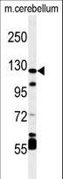 HIF1A / HIF1 Alpha Antibody - Western blot of HIF1Alpha Antibody in mouse cerebellum tissue lysates (35 ug/lane). HIF1Alpha (arrow) was detected using the purified antibody.