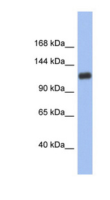 HIF1A / HIF1 Alpha Antibody - HIF1A antibody Western blot of Fetal Small Intestine lysate. This image was taken for the unconjugated form of this product. Other forms have not been tested.