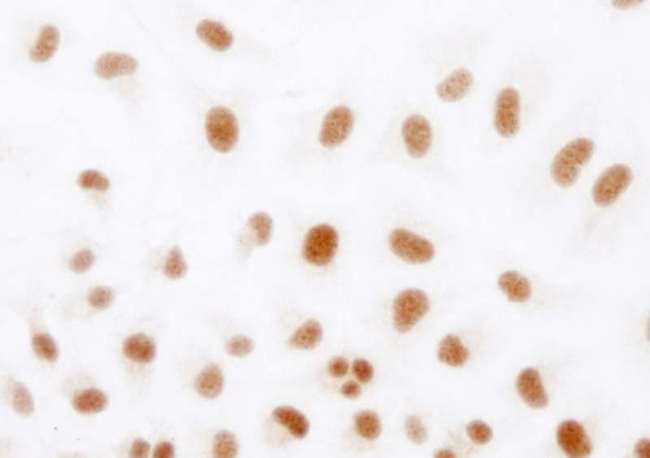 HIF1A / HIF1 Alpha Antibody - Detection of Human HIF1-alpha by Immunocytochemistry. Sample: Formaldehyde-fixed asynchronous hypoxic HeLa cells. Antibody: Affinity purified rabbit anti-HIF1-alpha used at a dilution of 1:250.