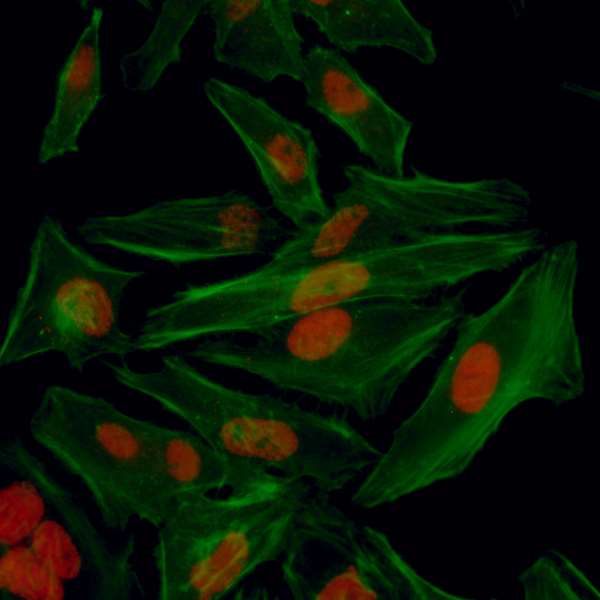 HIF1A / HIF1 Alpha Antibody - Detection of human HIF1-alpha by immunocytochemistry. Sample: Formaldehyde-fixed asynchronous hypoxic HeLa cells. Antibody: Affinity purified rabbit anti-HIF1-alpha used at a dilution of 1:100. Detection: Red fluorescence