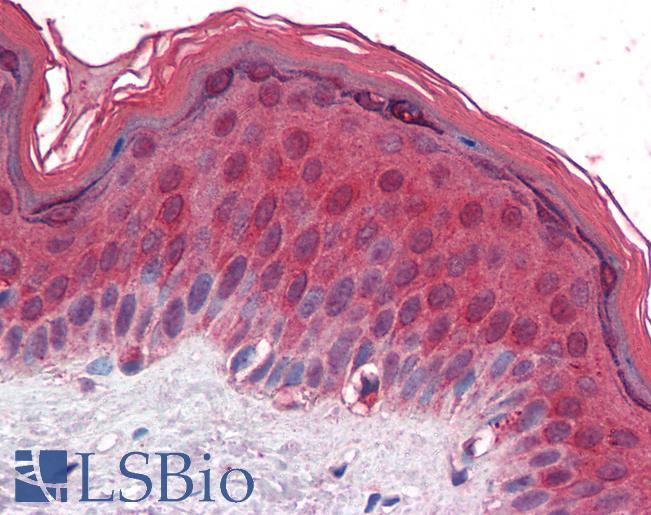 HIF1A / HIF1 Alpha Antibody - Anti-HIF1A antibody IHC of human skin. Immunohistochemistry of formalin-fixed, paraffin-embedded tissue after heat-induced antigen retrieval. Antibody dilution 1:100.  This image was taken for the unconjugated form of this product. Other forms have not been tested.