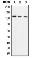HIF1A / HIF1 Alpha Antibody - Western blot analysis of HIF1 alpha expression in Raji (A); A431 (B); HeLa (C) whole cell lysates.