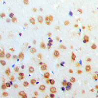 HIF1A / HIF1 Alpha Antibody - Immunohistochemical analysis of HIF1 alpha staining in human brain formalin fixed paraffin embedded tissue section. The section was pre-treated using heat mediated antigen retrieval with sodium citrate buffer (pH 6.0). The section was then incubated with the antibody at room temperature and detected using an HRP conjugated compact polymer system. DAB was used as the chromogen. The section was then counterstained with hematoxylin and mounted with DPX.