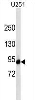 HIF1A / HIF1 Alpha Antibody - HIF1A western blot of U251 cell line lysates (35 ug/lane). The HIF1A antibody detected the HIF1A protein (arrow).