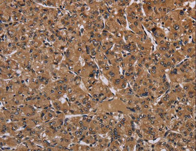 HIF1A / HIF1 Alpha Antibody - Immunohistochemistry of paraffin-embedded Human brain using HIF1A Polyclonal Antibody at dilution of 1:60.
