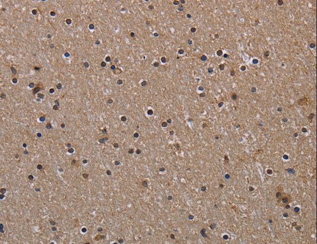HIF1A / HIF1 Alpha Antibody - Immunohistochemistry of paraffin-embedded Human brain using HIF1A Polyclonal Antibody at dilution of 1:60.