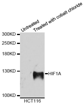 HIF1A / HIF1 Alpha Antibody - Western blot analysis of extracts of HCT116 cells.