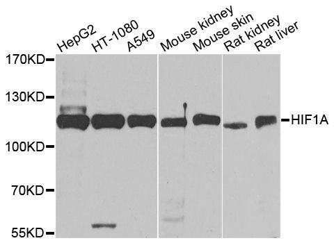 HIF1A / HIF1 Alpha Antibody - Western blot analysis of extracts of various cell lines, using HIF1A antibody at 1:1000 dilution. The secondary antibody used was an HRP Goat Anti-Rabbit IgG (H+L) at 1:10000 dilution. Lysates were loaded 25ug per lane and 3% nonfat dry milk in TBST was used for blocking. An ECL Kit was used for detection and the exposure time was 90s.