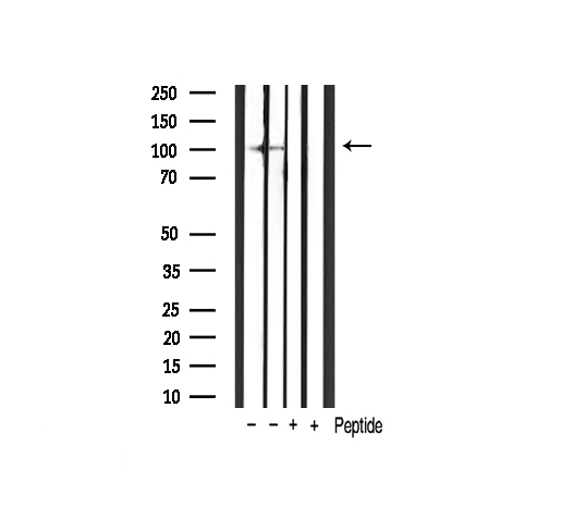 HIF1A / HIF1 Alpha Antibody - Western blot analysis of extracts of various sample using hif1a antibody.