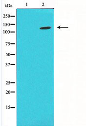 HIF1A / HIF1 Alpha Antibody - Western blot analysis on LOVO cells using HIF1a antibody. The lane on the left is blocked with the antigen-specific peptide.