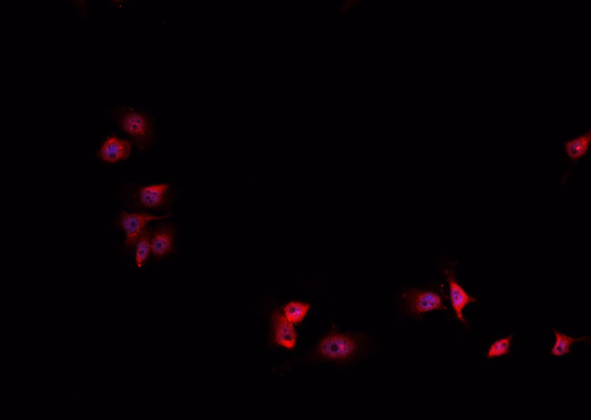 HIF1A / HIF1 Alpha Antibody - Staining HeLa cells by IF/ICC. The samples were fixed with PFA and permeabilized in 0.1% Triton X-100, then blocked in 10% serum for 45 min at 25°C. The primary antibody was diluted at 1:200 and incubated with the sample for 1 hour at 37°C. An Alexa Fluor 594 conjugated goat anti-rabbit IgG (H+L) antibody, diluted at 1/600, was used as secondary antibody.