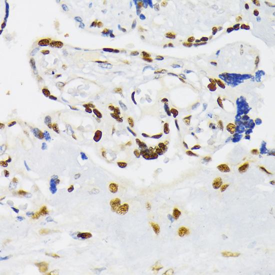 HIF1A / HIF1 Alpha Antibody - Immunohistochemistry of paraffin-embedded Human placenta using HIF1A Polyclonal Antibody at dilution of 1:200 (40x lens).