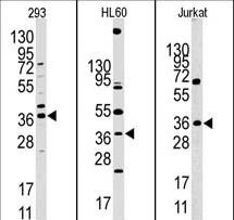 HIF1AN Antibody - Western blot of anti-HIF1AN antibody in 293, HL60 and Jurkat cell line lysates. HIF1AN (arrow) was detected using the purified antibody.