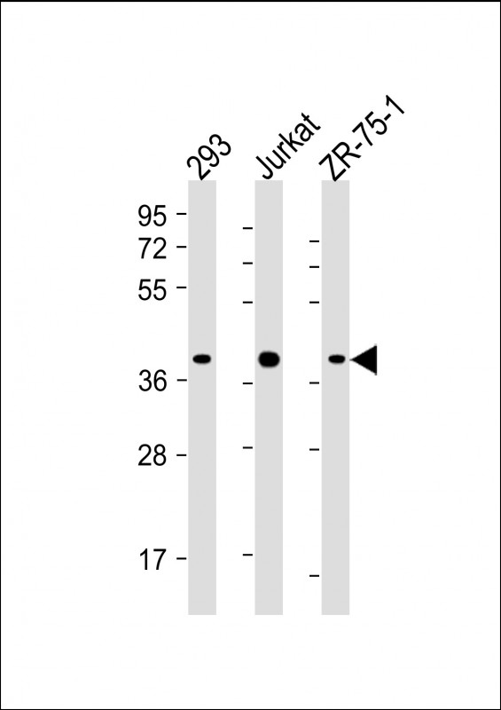 HIF1AN Antibody - All lanes: Anti-HIF1AN Antibody (C-term) at 1:4000 dilution Lane 1: 293 whole cell lysate Lane 2: Jurkat whole cell lysate Lane 3: ZR-75-1 whole cell lysate Lysates/proteins at 20 µg per lane. Secondary Goat Anti-mouse IgG, (H+L), Peroxidase conjugated at 1/10000 dilution. Predicted band size: 40 kDa Blocking/Dilution buffer: 5% NFDM/TBST.
