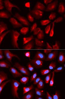 HIF1AN Antibody - Immunofluorescence analysis of U20S cells.