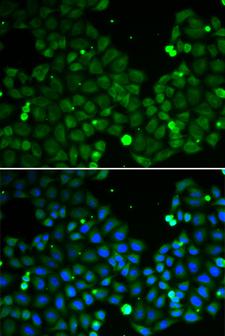 HIF1AN Antibody - Immunofluorescence analysis of A549 cells.