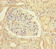 HIF1AN Antibody - Immunohistochemistry of paraffin-embedded human kidney tissue using HIF1AN Antibody at dilution of 1:100